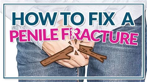 You can finance procedures ranging from $1,000 to$25,000. . Penile fracture surgery cost